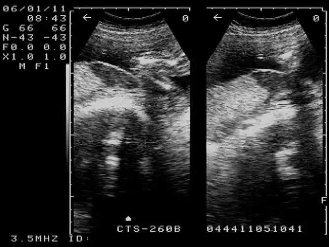 求助原创胎盘血窦