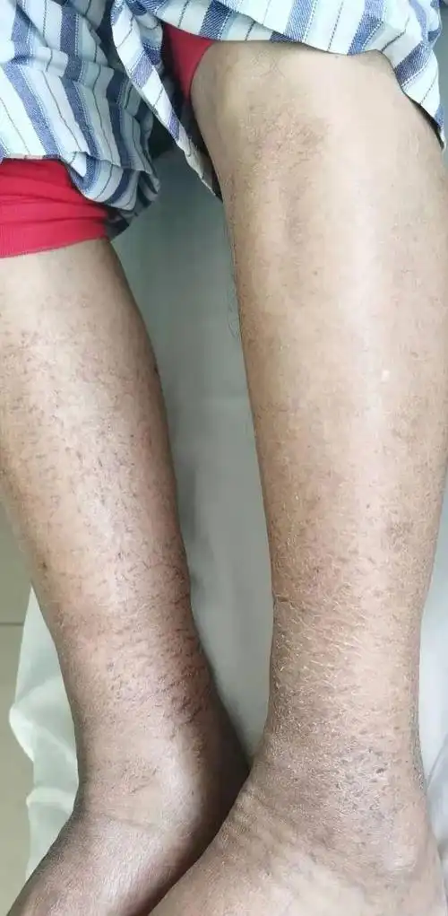 冬天皮肤干燥瘙痒脱皮怎么治(冬季皮肤干燥瘙痒)(5)