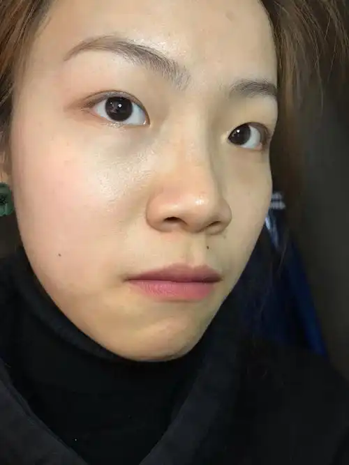 新氧体验官 上了大学以来皮肤状态越来越差