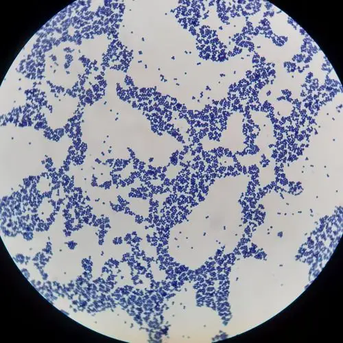 其实就是葡萄球菌在作祟,用银花,菊花等中草药泡水喝就行