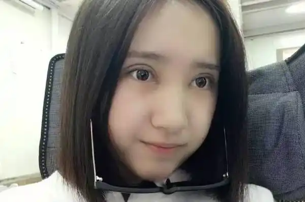 双眼皮术后7天全记录,拆线后秒变二次元萌妹!