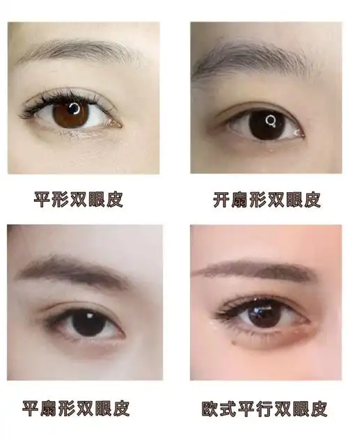 扇形平行平扇双眼皮