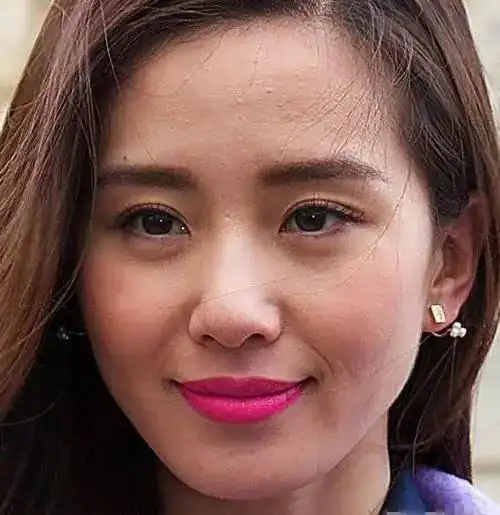 其实明星离开了修图软件 也和正常人一样有许多困扰 比如 闭口, 黑头