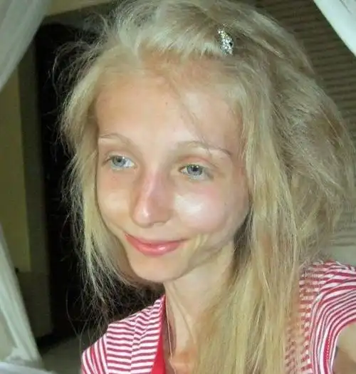 她身高160厘米,体重却只有42斤,严重偏瘦,成了减肥的反面教材.