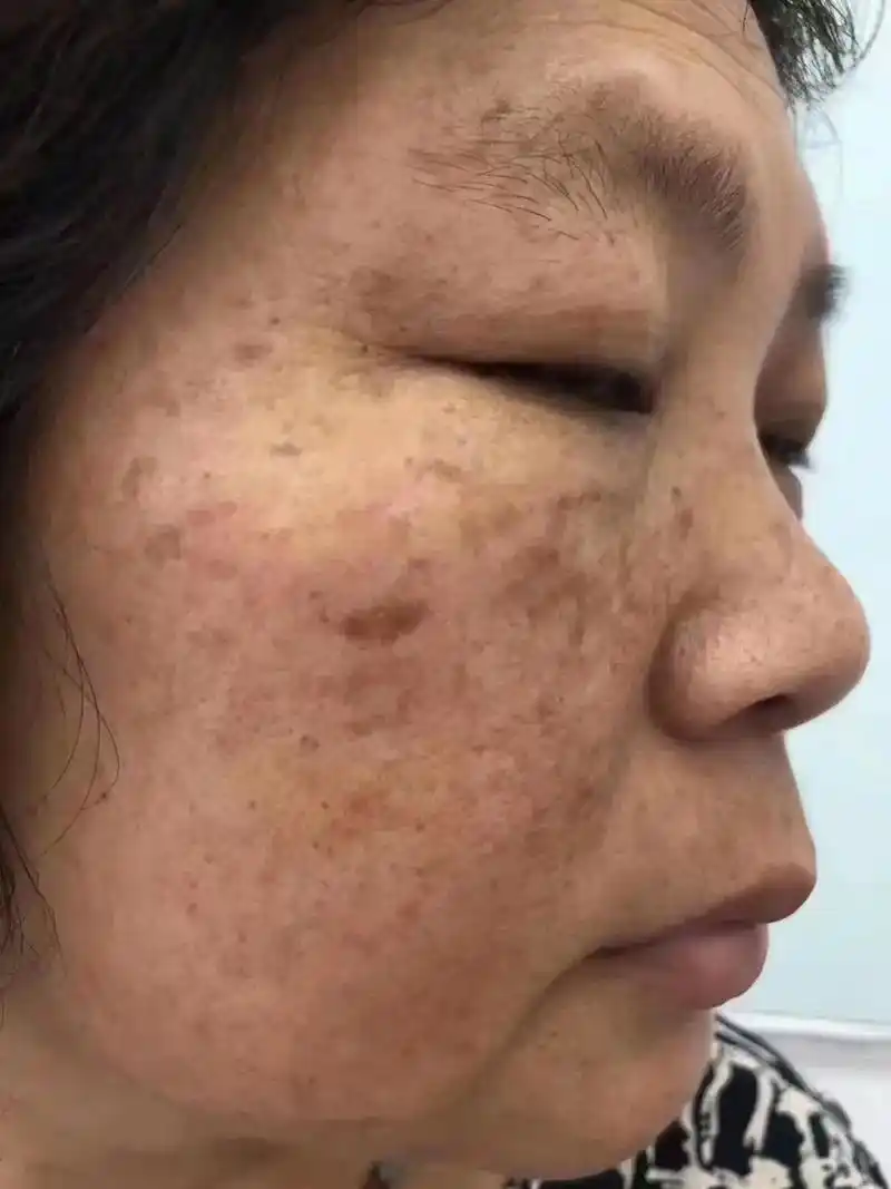 珈黛解决面部35种皮肤问题,告别肌肤问题,专业的事交给专业的 - 抖音