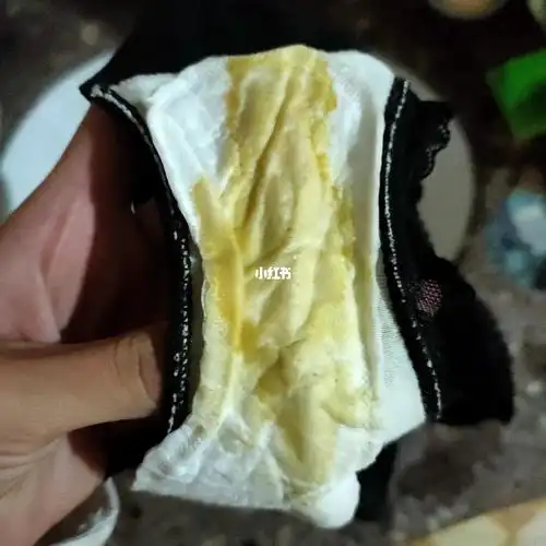 这样做99霉菌性阴道炎真的不再复发了