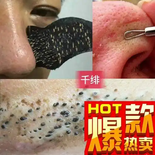 专业去黑头粉刺,只要用对方法一帖见效