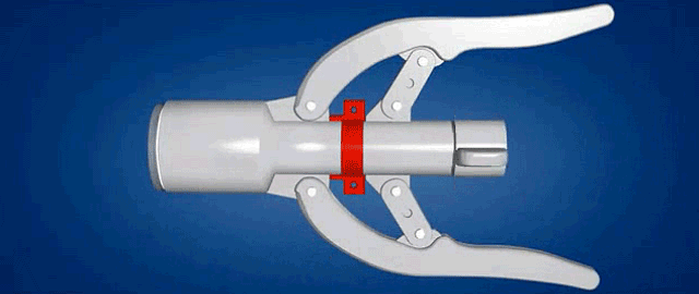 江苏瑞爱普包皮环切吻合器一次性使用包皮切割缝合器医用环切器12号