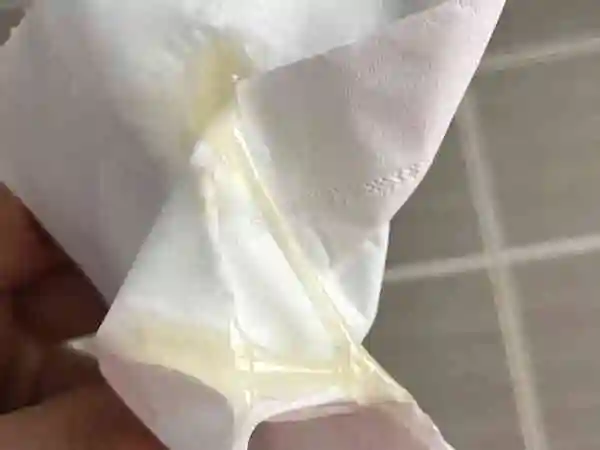 正常排卵流出来的液体图片长什么样