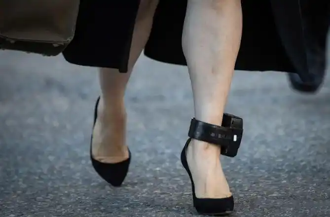 照片显示孟女士脚踝处已经出现了一团淤青.