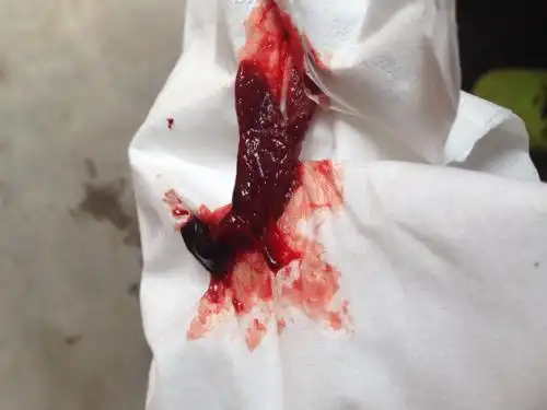 以前没有,最近有.跪问这是