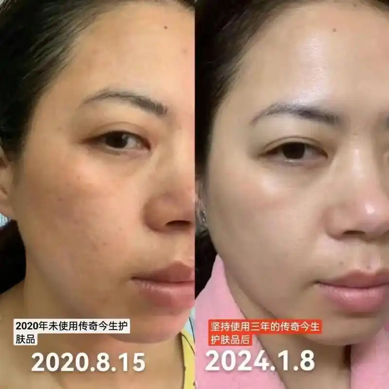 传奇今生护肤品36615年前后对比9595 ……三年前,未 - 抖音