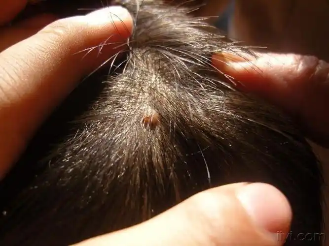 (图片超过100k,良版已修改,下次注意)