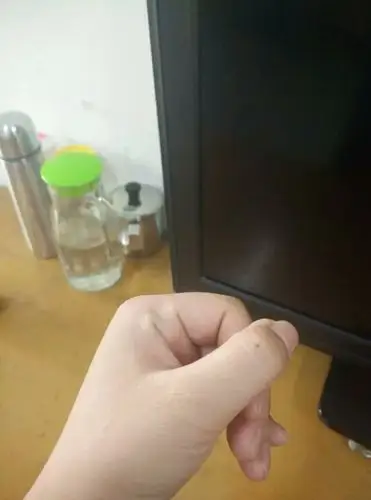 左手大拇指有一颗痣.据说是旺夫痣,不知道真的还是假的?