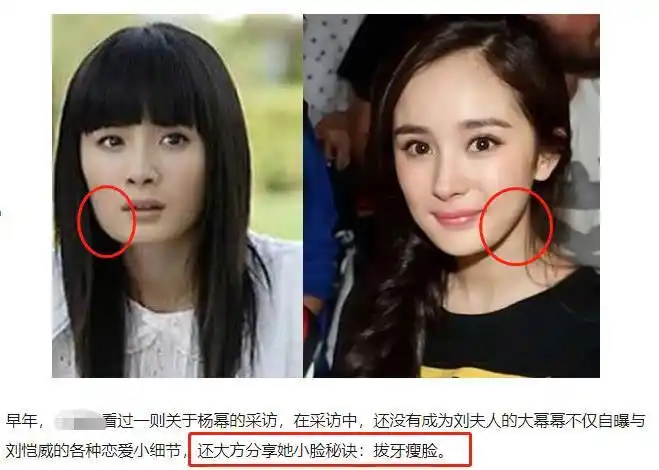 杨幂有没有整容