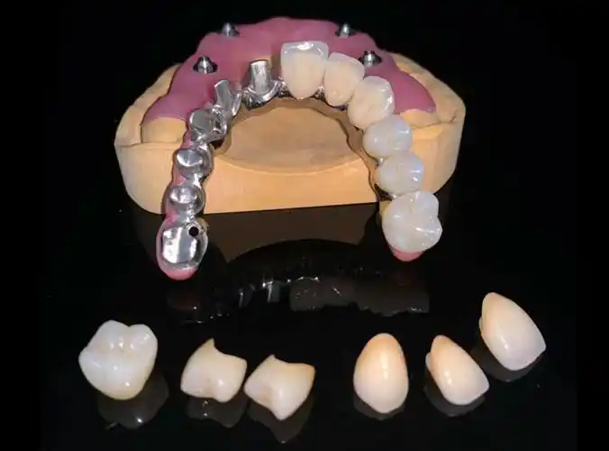 纯钛桥架-纯钛桥架-淄博百合义齿有限公司是一家综合型定制式义齿加工