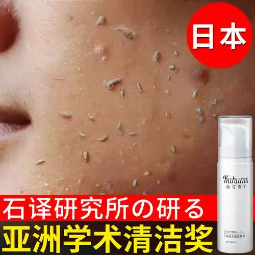 日本去角质慕斯面部女男清洁收缩毛孔脸部去死皮黑头螨虫深层清洁