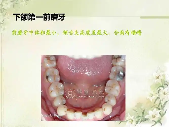 2012级第4次课口腔解剖生理学 (切牙,尖牙)ppt_word文档在线阅读与下