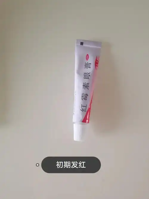 症状有点红  未破皮未流水  用红霉素眼膏 注意哦是眼膏而不是软