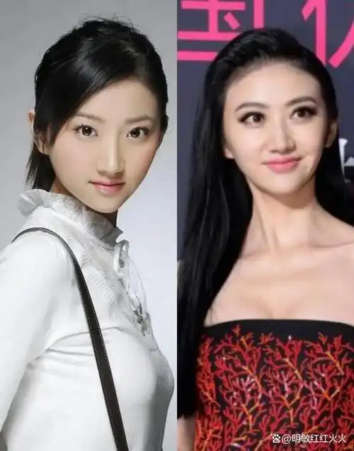 娱乐圈整容迷局!景甜整容前后大变样,三大原因让你深入了解!
