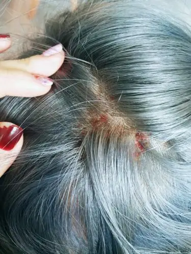 快过年了染发失败结果这么惨!