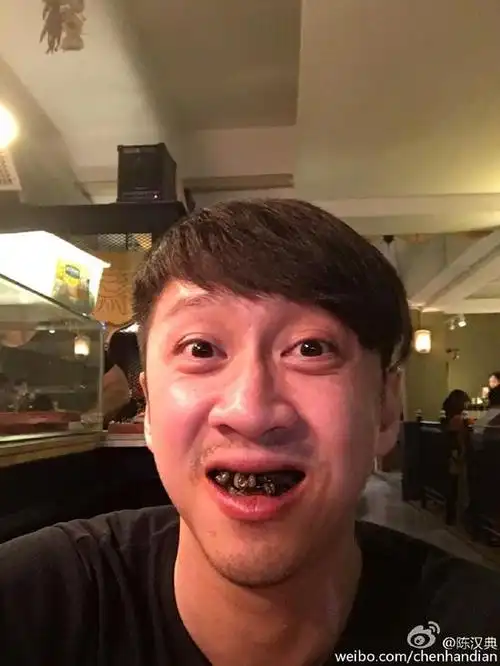 陈汉典洗牙自黑照超丑