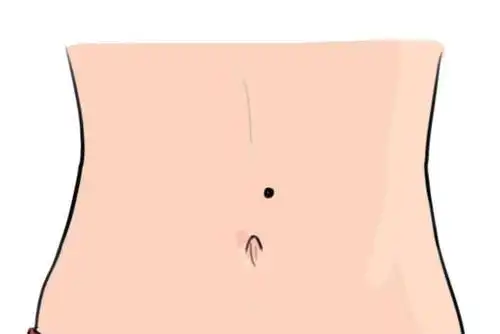 原创这个部位有痣代表"星",听者有星,偏财犹如满天星斗!