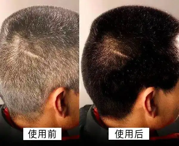 "白发一根,显老十岁":做这件事,让你头发又黑又亮