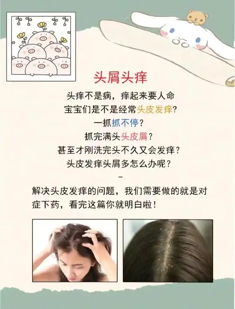 头屑头痒难受抓不停?头皮护理你做对了吗?头屑头痒难受抓不停? - 抖音