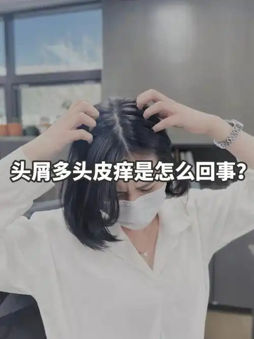 头屑多头皮痒是怎么回事