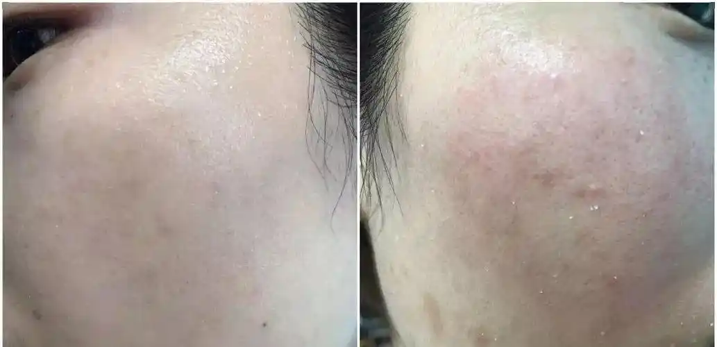 不知道它,你买再贵的护肤品都没用!_角质