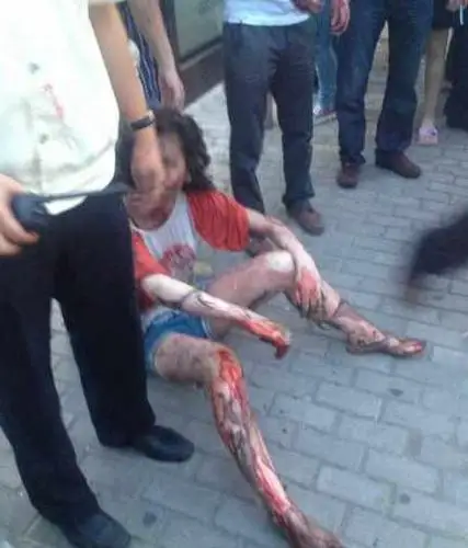 厦门brt公车爆炸致47人死亡34人受伤(组图)