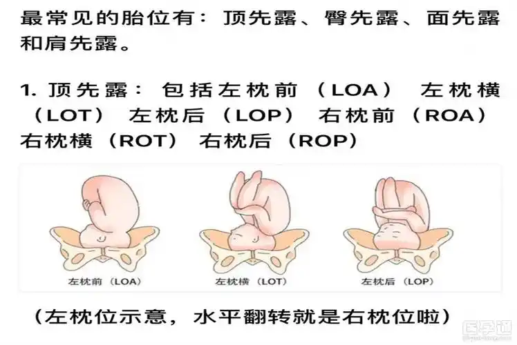 loa胎位在肚子里的图片分享,是好是坏一文知晓