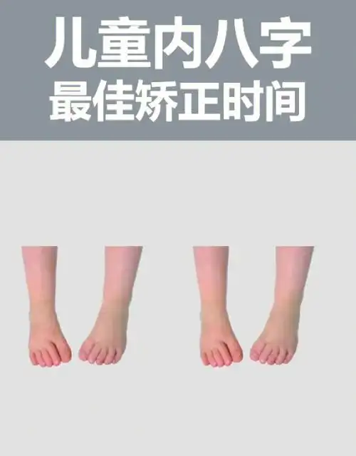 儿童内八字最佳矫正时间