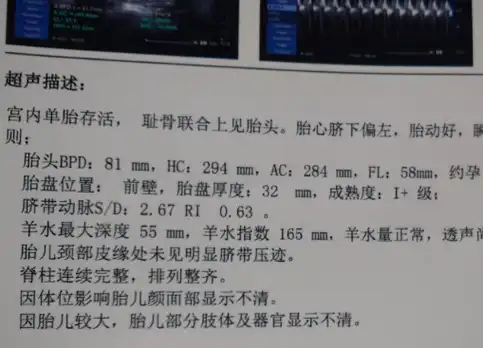 处于一种缺氧的状况,如果胎儿的胎心率在150次每分钟左右,那么怀女宝