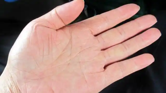 好消息!通过左手掌这个部位可以看出胃癌,赶快自测下吧!