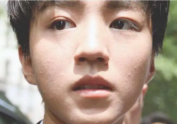 原创男明星的卸妆死看到王俊凯的真实素颜网友彻底幻灭了