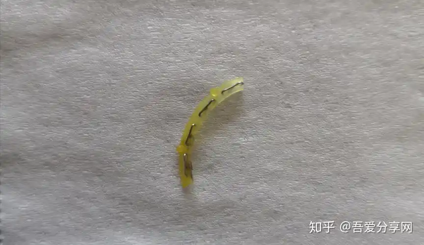 但看了下伤口,发现没什么大碍,钉子正在逐渐脱落,相信离完全恢复不远