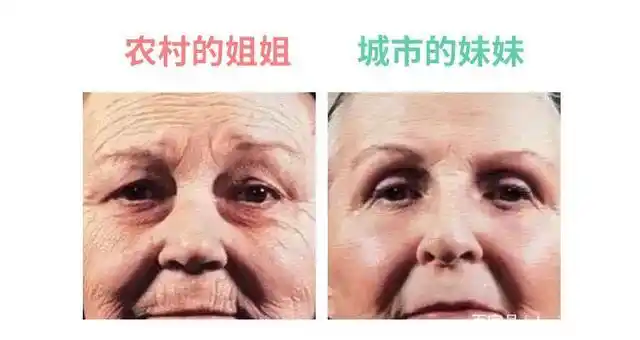 抗衰老的意义在于哪里?面部28种皱纹有哪些?(抗皱方法精选)