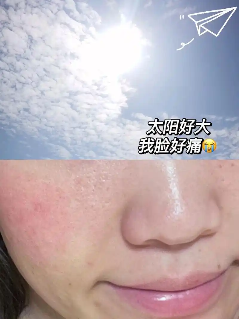 98夏天到了,仙女们可不要晒黑了哦.晒后修复大全,学起来,让 - 抖音