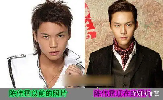 【图】陈伟霆整容前后对比照片的那些小整小弄_五官整形_美容-伊秀