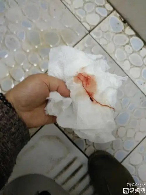 排卵期白带有血