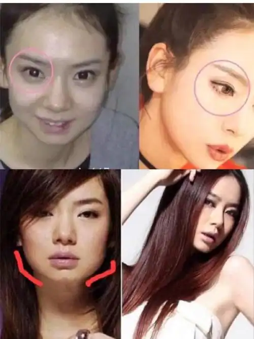 戚薇整容后事业爱情双丰收,开挂的人生不需要解释!