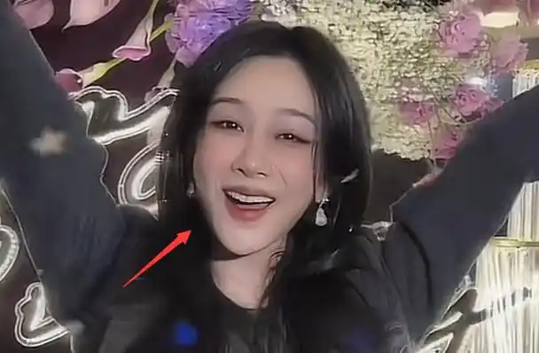 杨紫被质疑整容晒庆生照模样大变满脸通红脸肿僵硬不自然