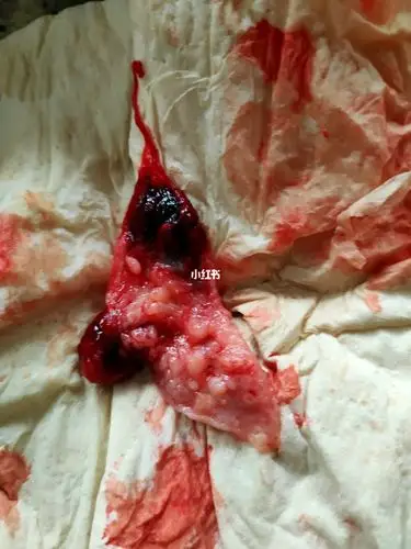 宝宝跟我50天就没了,,为什么不跟我走到最后了,你先不要妈妈了对吗