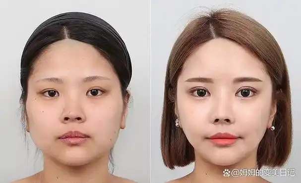 短宽脸怎么变美?来看看吧