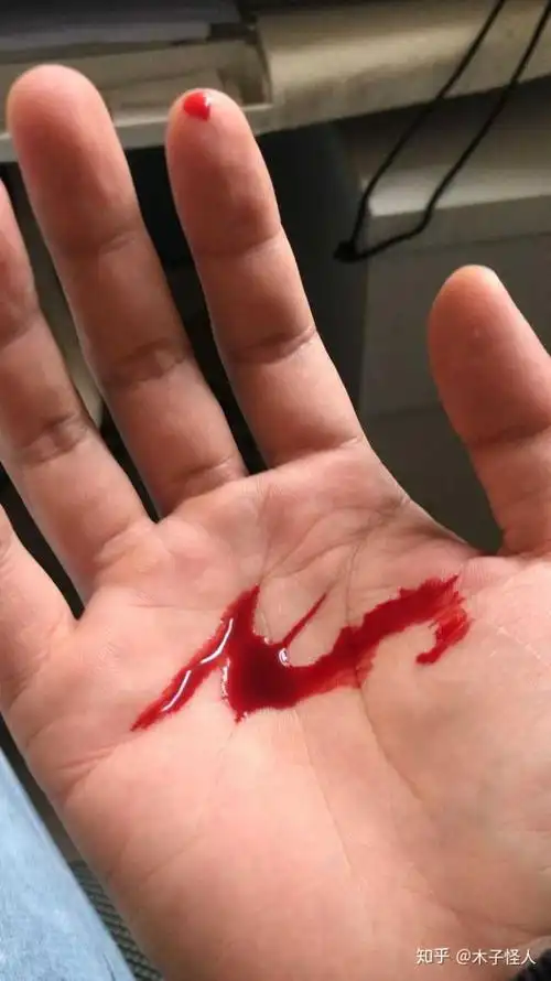 用手握住刀刃在手掌上划一刀会留下疤吗.