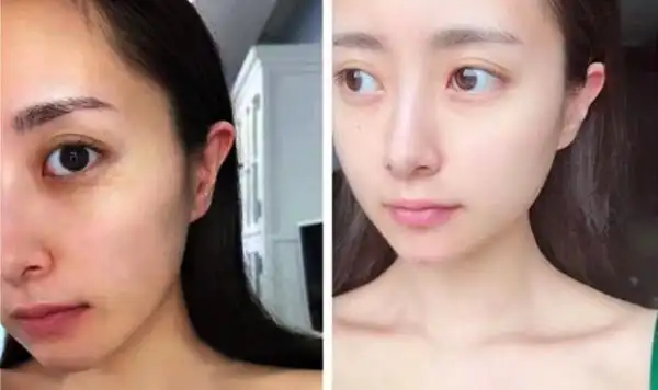 lily:皮肤一直比较黄,                  总被人说气色不好