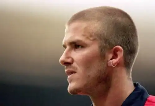 45岁的贝克汉姆秃了!发际线严重后移,头顶发量稀疏,网友大呼认不出