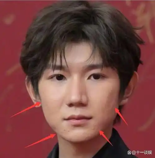 王源电影节红毯状态翻车,浓妆掩盖不住痘坑,眼神憔悴显沧桑